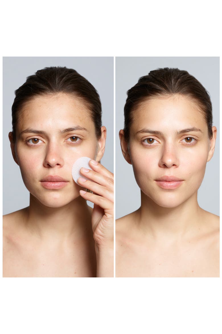 Full Size Correct and Brighten® Beta Hydroxy Pads Daily Exfoliator ...