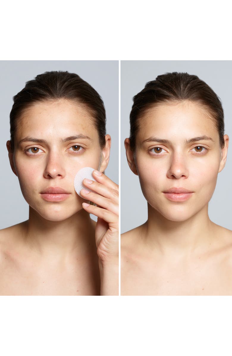 Trish McEvoy Correct and Brighten<sup>®</sup> Beta Hydroxy Pads, Alternate, color,