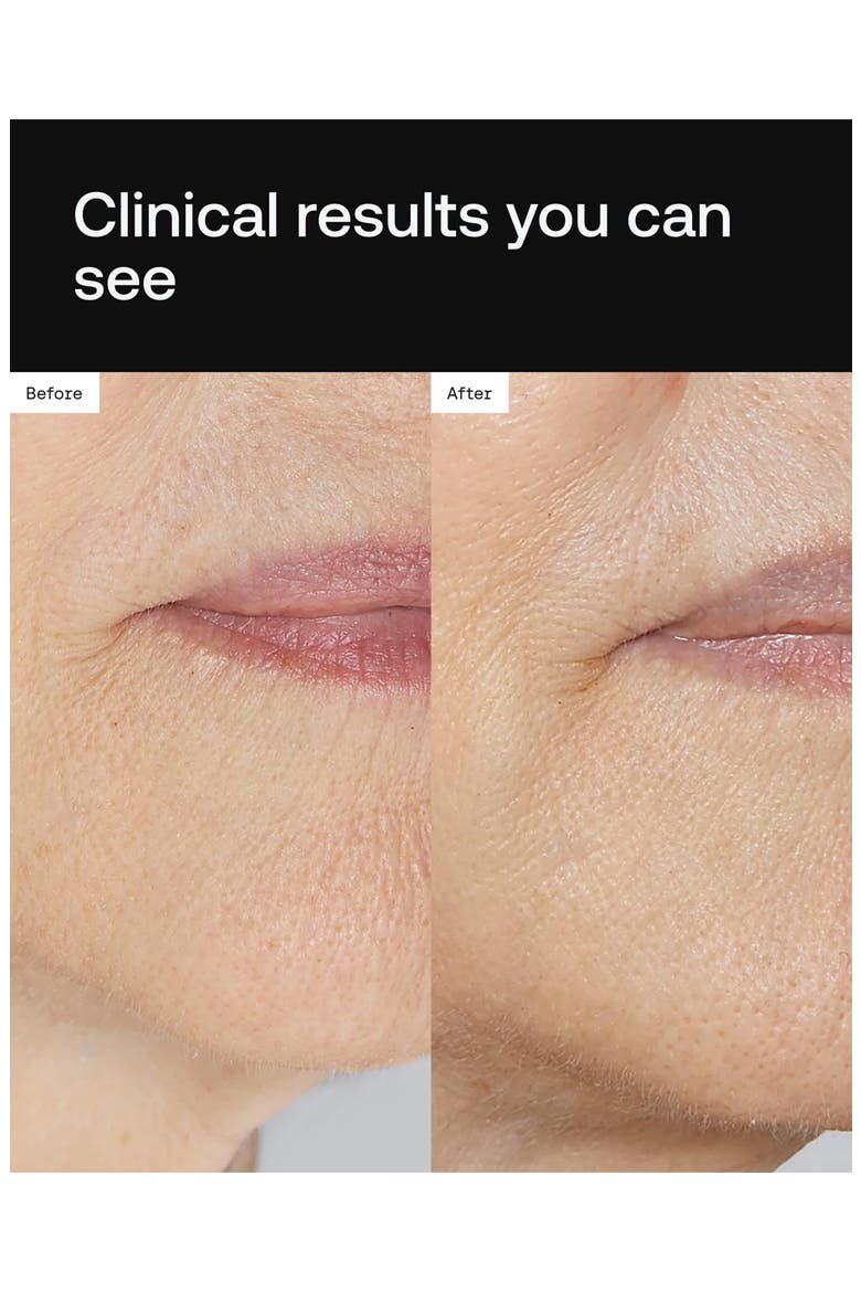 Cell Forté Serum with BIOMSC™, Alternate, color, NO COLOR