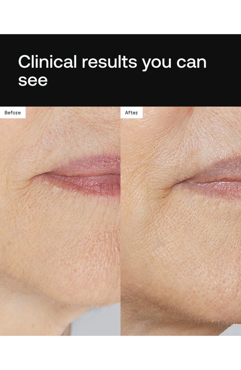 Angela Caglia Cell Forté Serum with BIOMSC<sup>™</sup>, Alternate, color, 