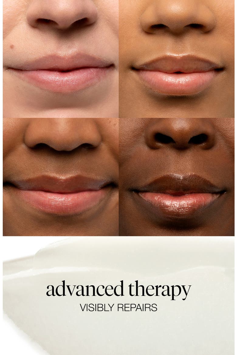 Sugar Advanced Therapy Lip Treatment, Alternate, color, NO COLOR