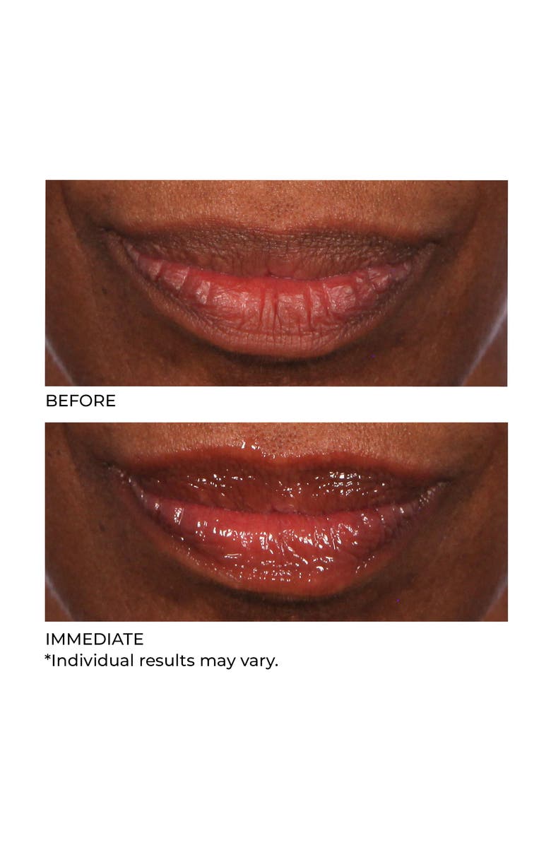 Dr. Nassif Skincare Hydro-Screen for Lips, Alternate, color, Pink Champagne