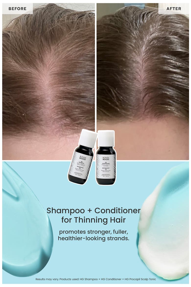 Grow Getter Mini Travel Hair Kit $48 Value, Alternate, color, NO COLOR