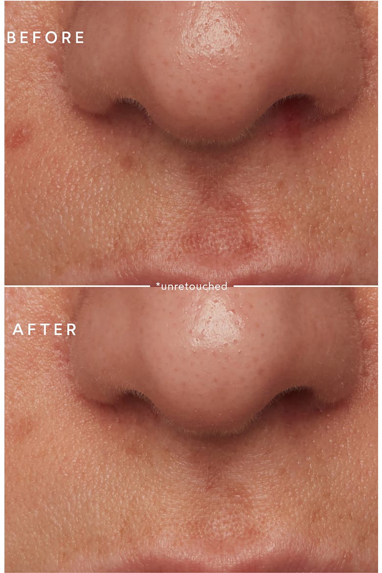 Microbiome Enzyme Essence, Alternate, color, NO COLOR