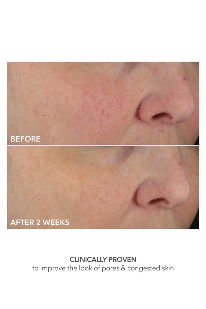 Advanced Retinol + Ferulic Perfectly Dosed Retinol Universal 0.2%, Alternate, color, NO COLOR