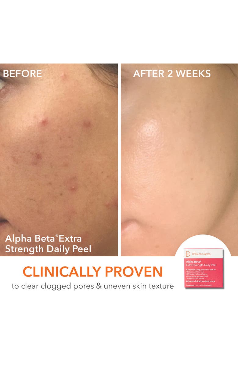 Dr. Dennis Gross Skincare AM/PM Gold Standard Kit (Limited Edition) USD $184 Value, Alternate, color, 