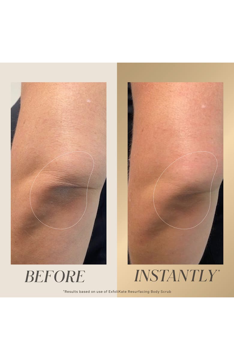 Kate Somerville<sup>®</sup> ExfoliKate<sup>®</sup> All Over Glow Face & Body Kit USD $154 Value, Alternate, color, 