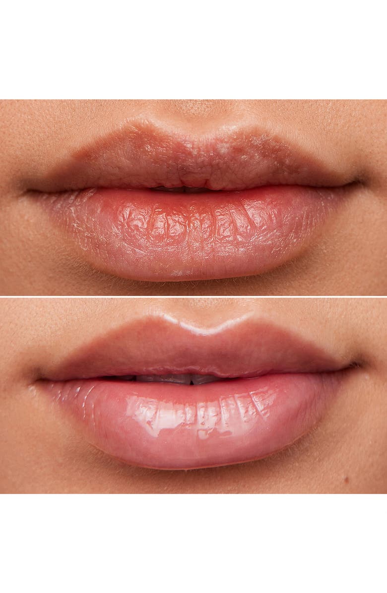 WONDERSKIN Lip Rehab Serum-in-Oil, Alternate, color, NO COLOR