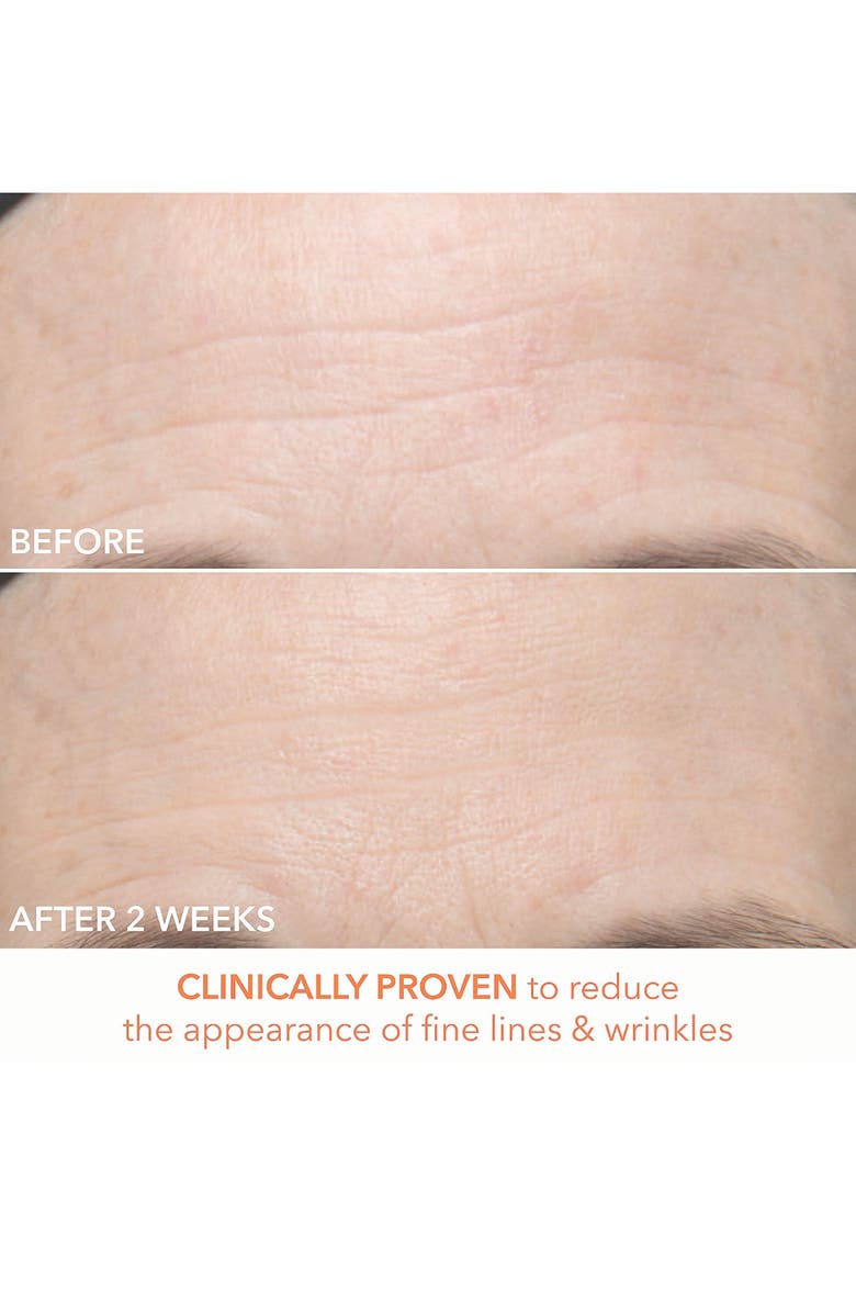 Dr. Dennis Gross Skincare Alpha Beta<sup>®</sup> Ultra Gentle Daily Peel - 30 Applications, Alternate, color, 