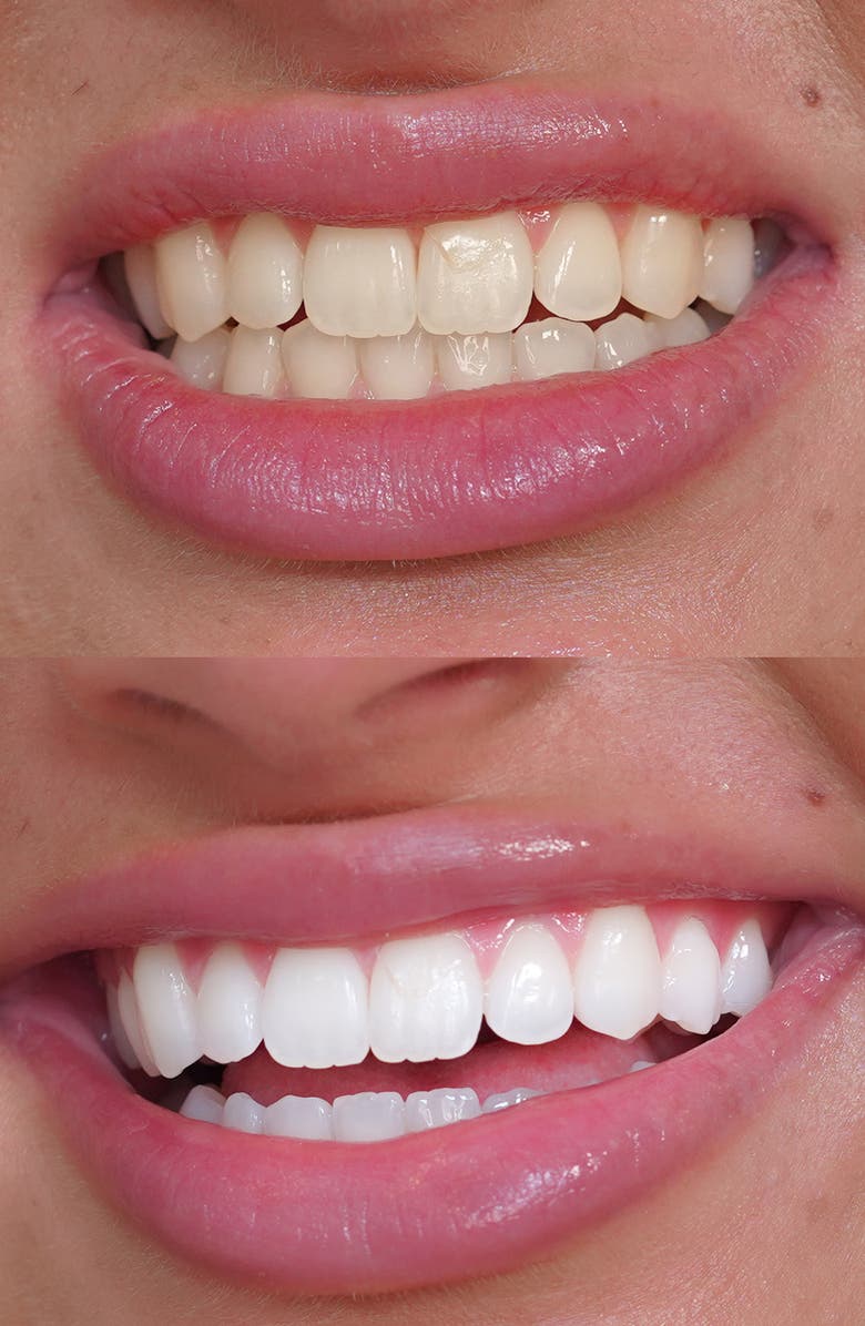 SNOW Diamond Teeth Whitening Serum, Alternate, color,