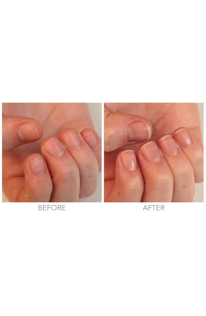 Londontown Restorative Nail Cream, Alternate, color,