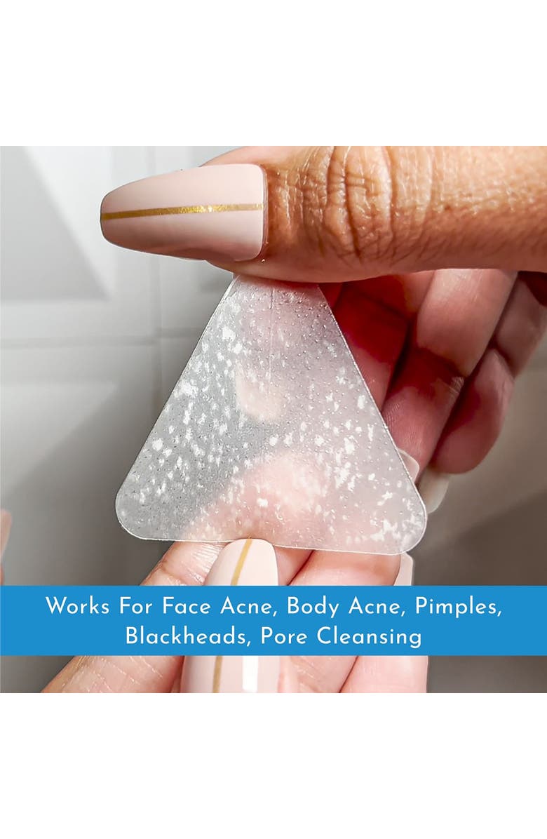 TRULY CLEAR Acne Zone Patches, 10 Count, 3 Sizes, Alternate, color, Multicolored