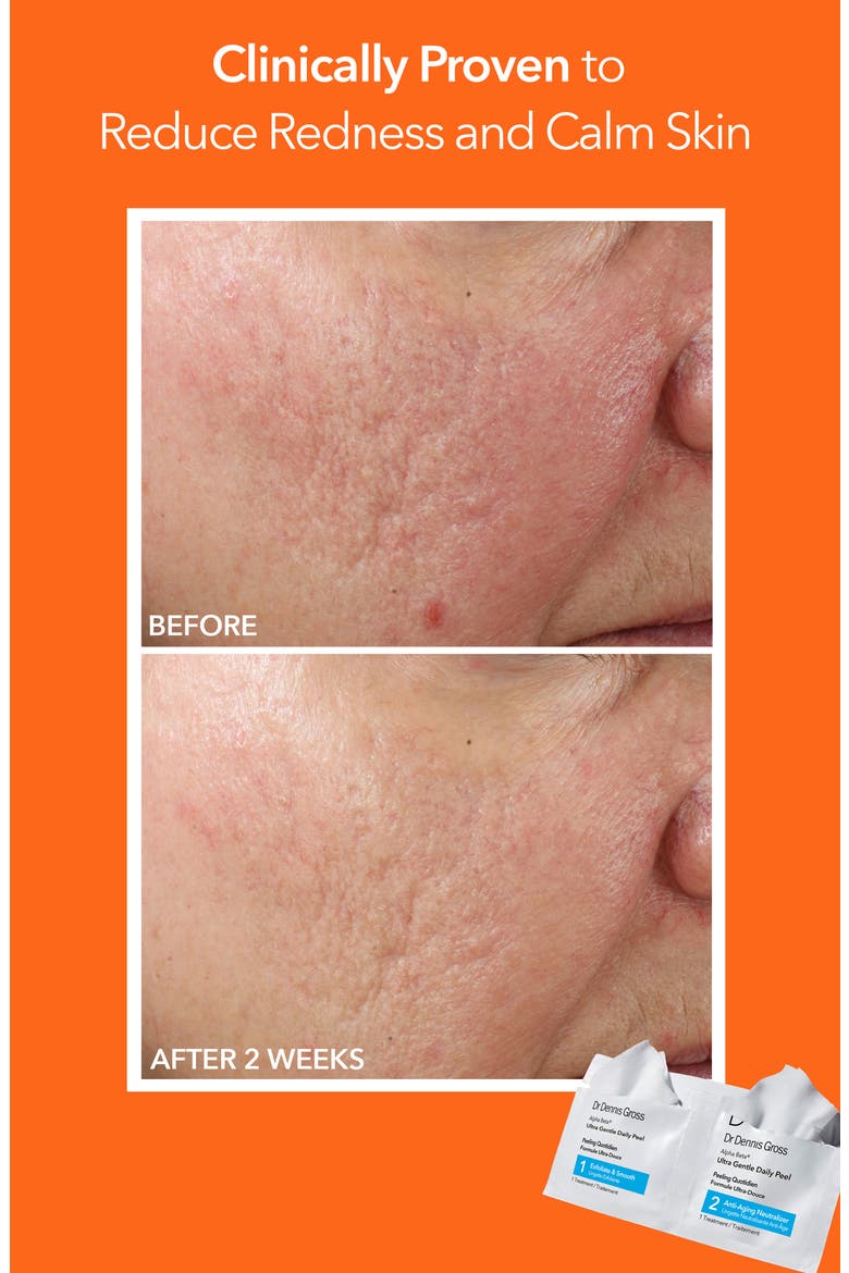 Alpha Beta® Ultra Gentle Daily Peel - 30 Applications, Alternate, color, NO COLOR