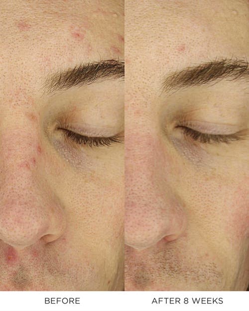 Noble Panacea The Exceptional Overnight Chronobiology Peel In White