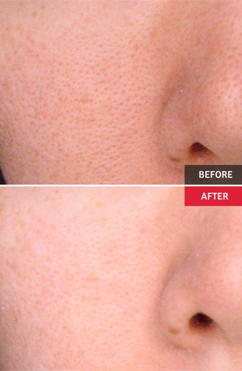 Vitabrid C12 Face Brightening Powder, Alternate, color,