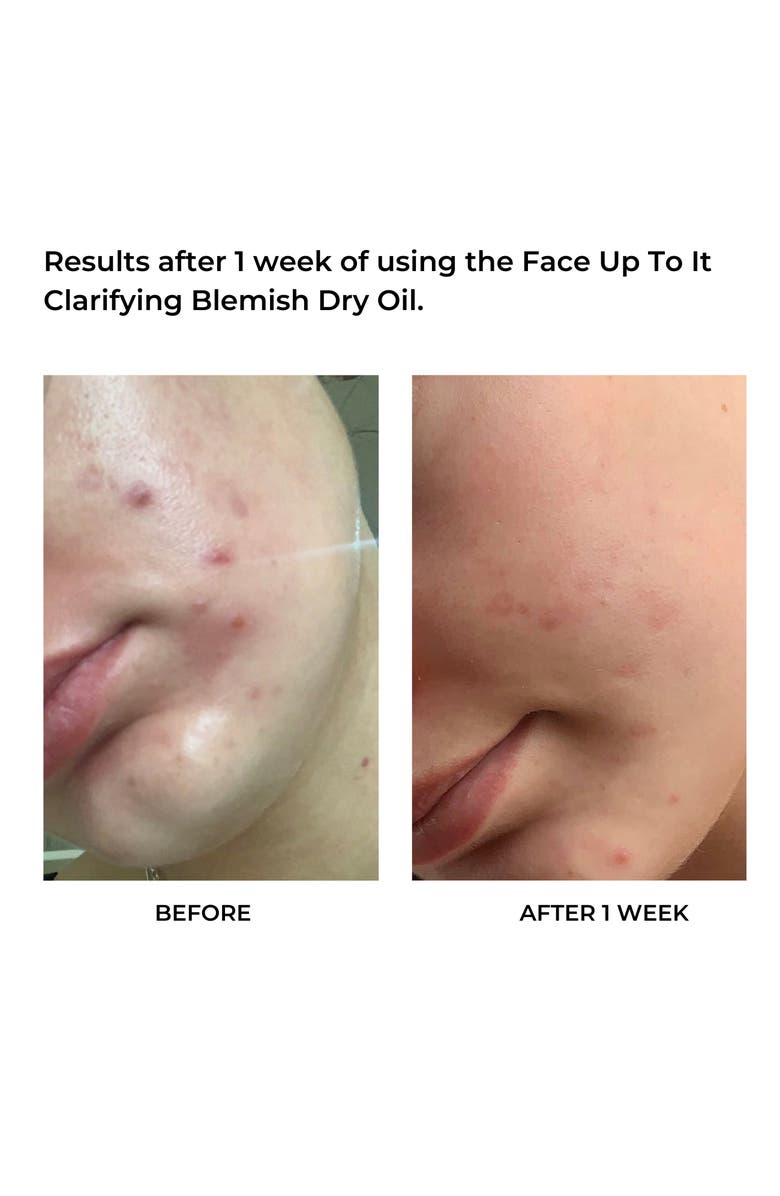 evre. Face Up To It Clarifying Dry Oil, Alternate, color,