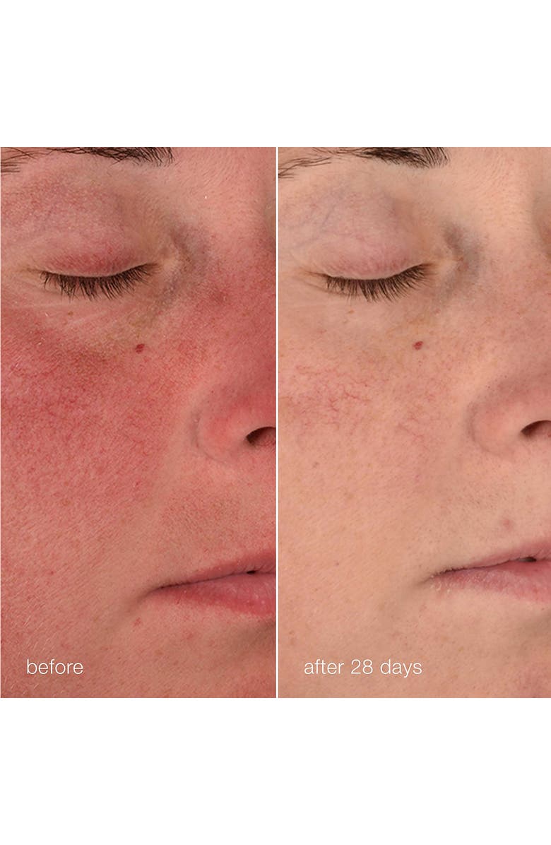 dermalogica<sup>®</sup> Stabilizing Repair Cream, Alternate, color, 