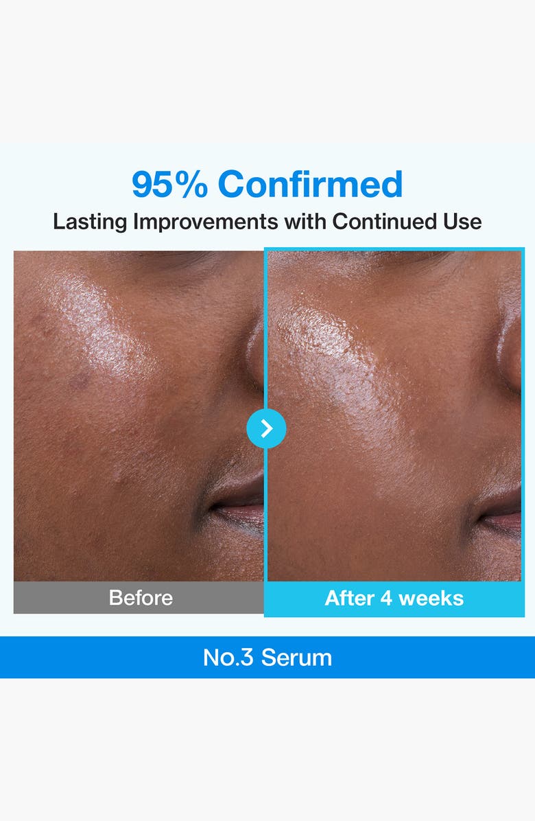 Numbuzin No.3 Blue Bio-Retinol Pore Refining Serum, Alternate, color,