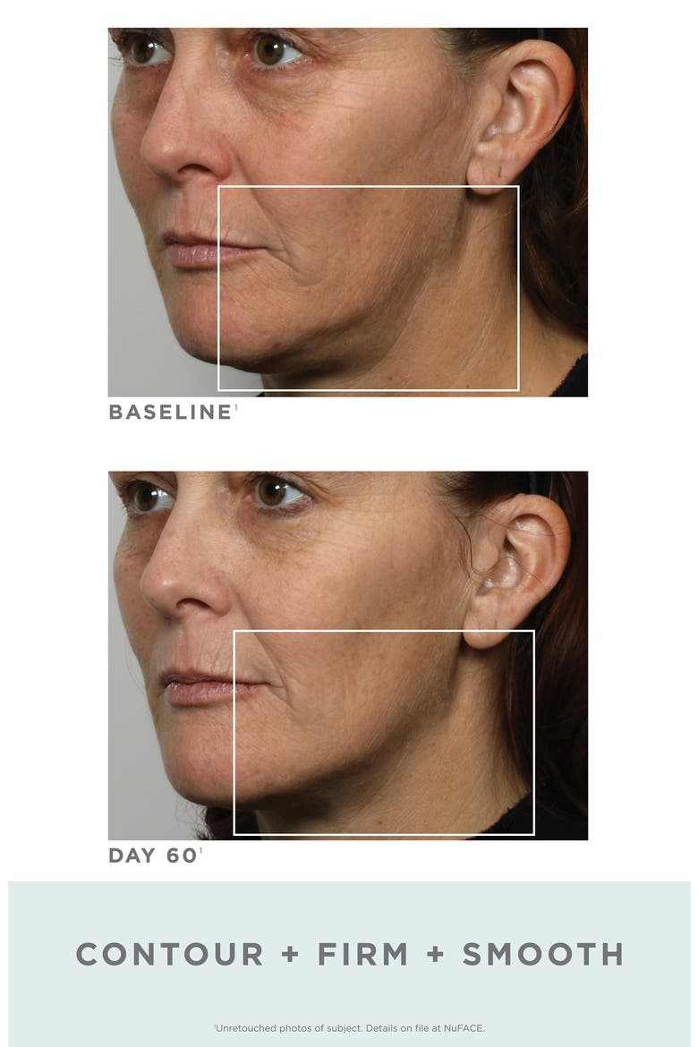 Trinity® Facial Toning Kit $339 Value, Alternate, color, NO COLOR