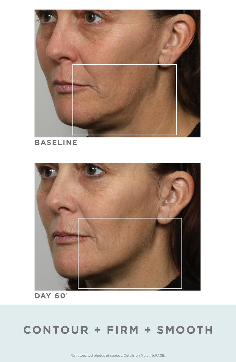 NuFACE<sup>®</sup> Trinity Facial Toning Device, Alternate, color,