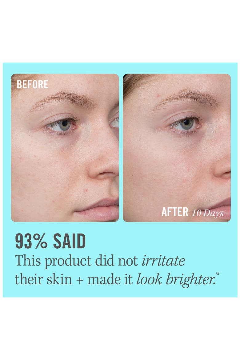 10% Vitamin C Brightening Serum, Alternate, color, NO COLOR