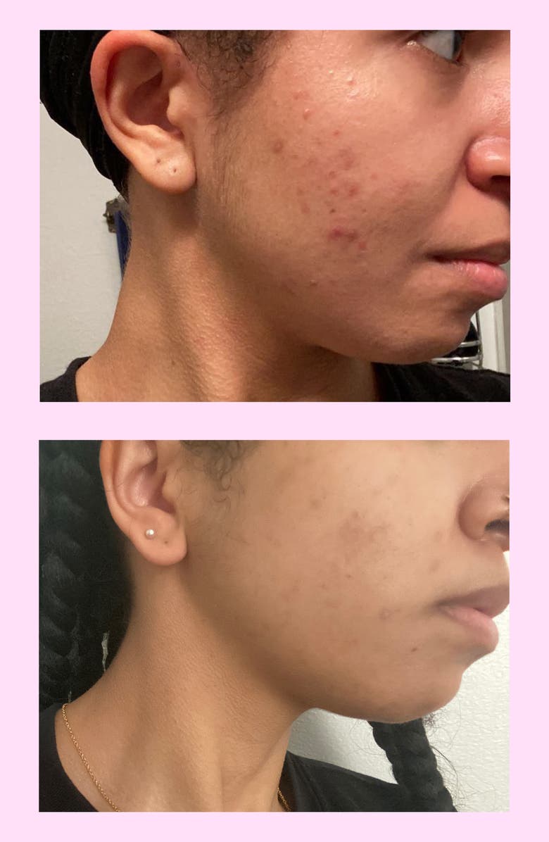 ROSEN Earth Mask, Alternate, color, 