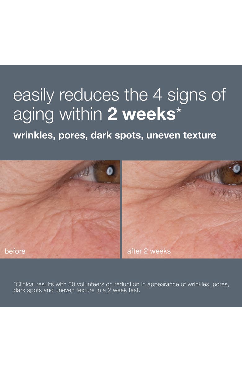 dermalogica<sup>®</sup> Dynamic Skin Retinol Renewal Serum, Alternate, color, 