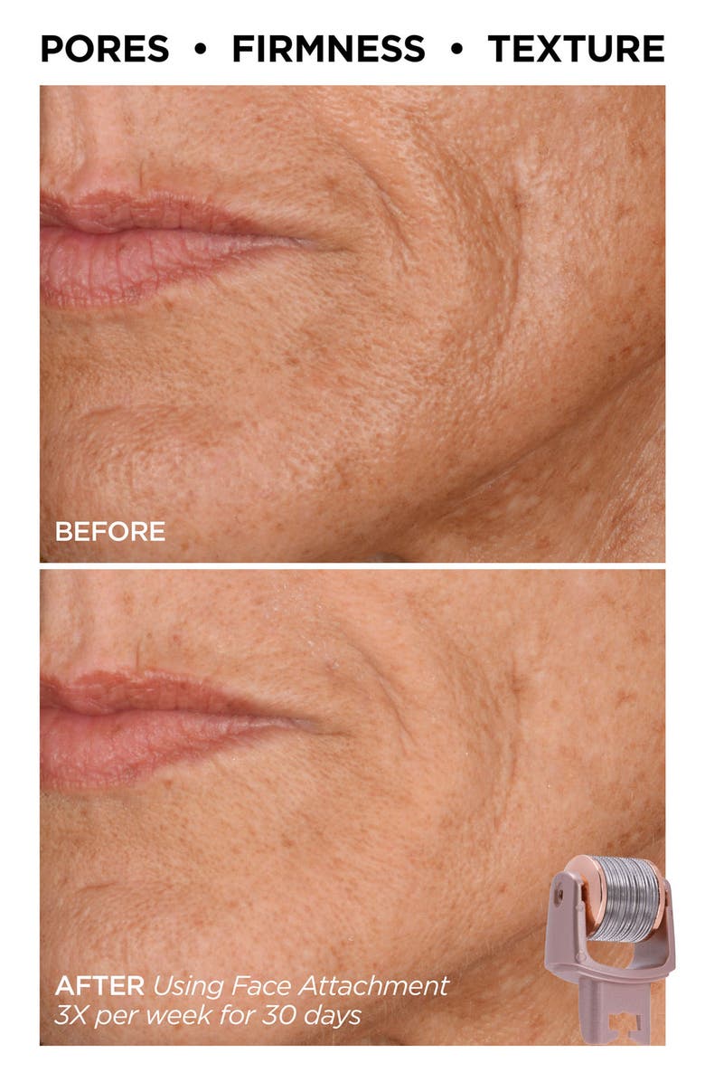 BeautyBio GloPRO<sup>®</sup> Skin & Hair Goals Set $353 Value, Alternate, color, 