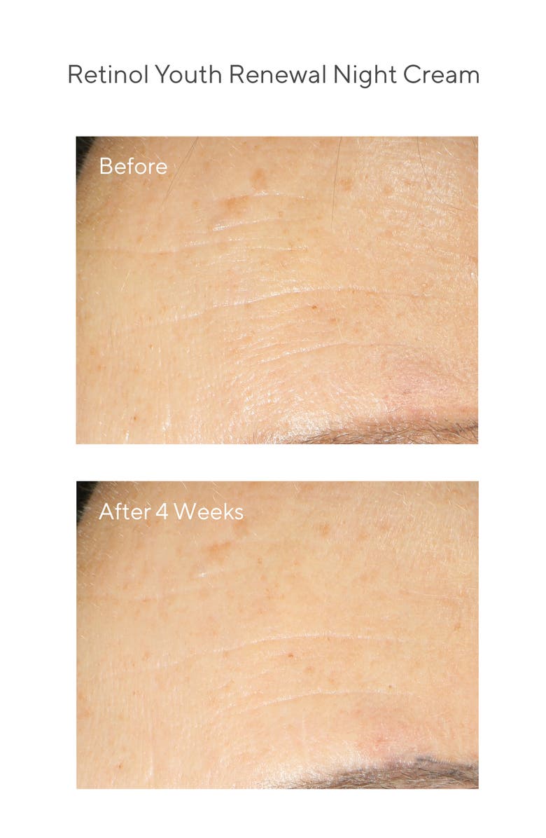 Murad<sup>®</sup> Youth Renewal Retinol Discovery Set, Alternate, color, 