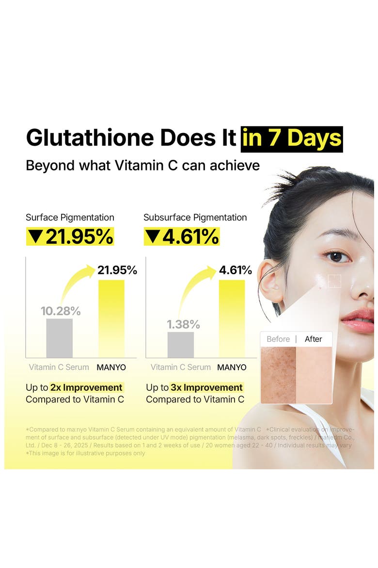 Glutathione 7 Dark Spot Serum, Alternate, color, LIGHT/ PASTEL YELLOW