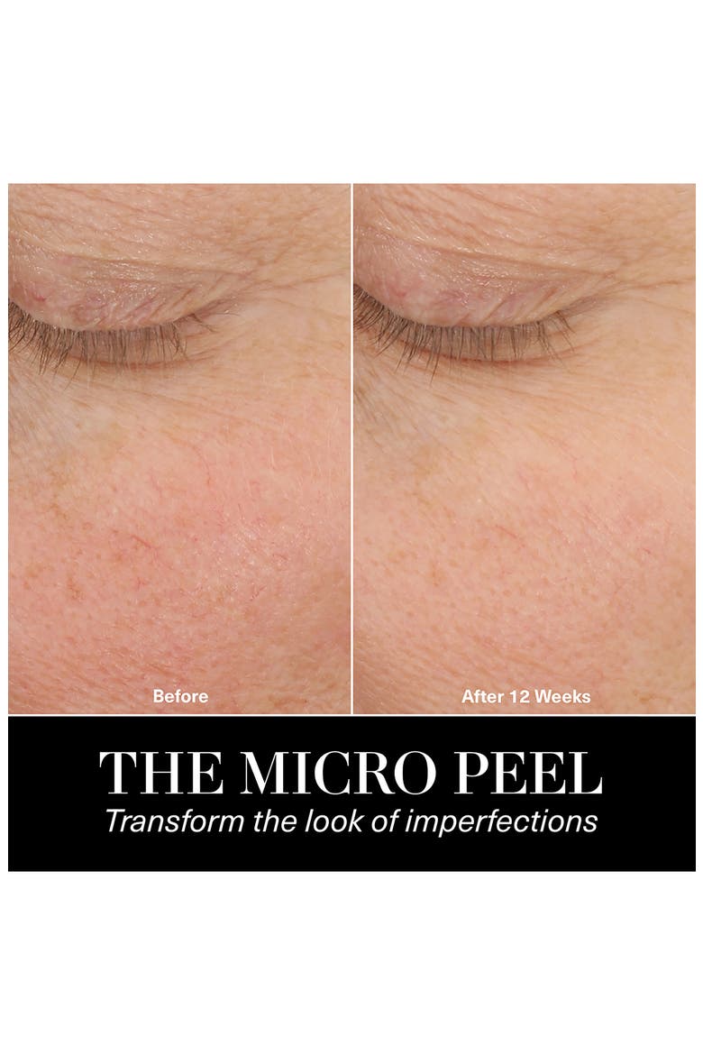The Resurfacing Micro Peel Treatment for Anti-Aging, Alternate, color, NO COLOR