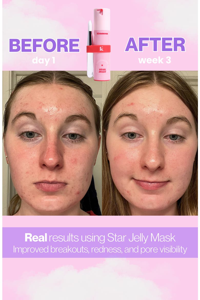 Star Jelly Magic Resurfacing Facial, Alternate, color, CREAM