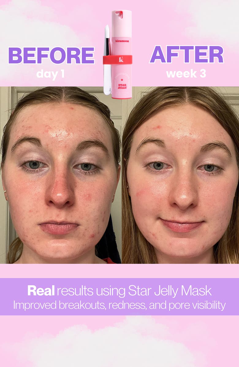 Kiramoon Star Jelly Magic Resurfacing Facial, Alternate, color, Cream