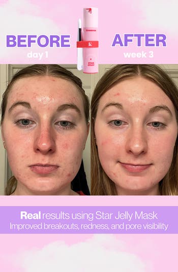 Star Jelly Magic Resurfacing Facial