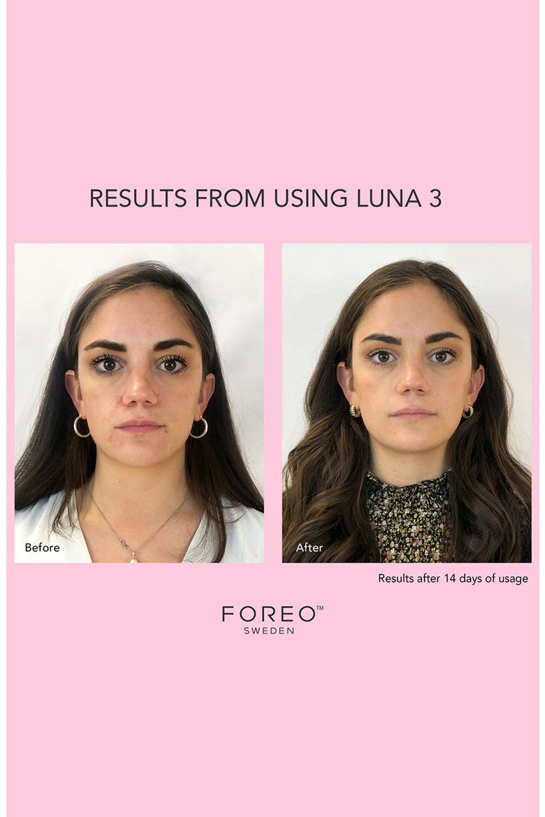 LUNA™ 3 Sensitive Skin Facial Cleansing & Firming Massage Device, Alternate, color, NO COLOR