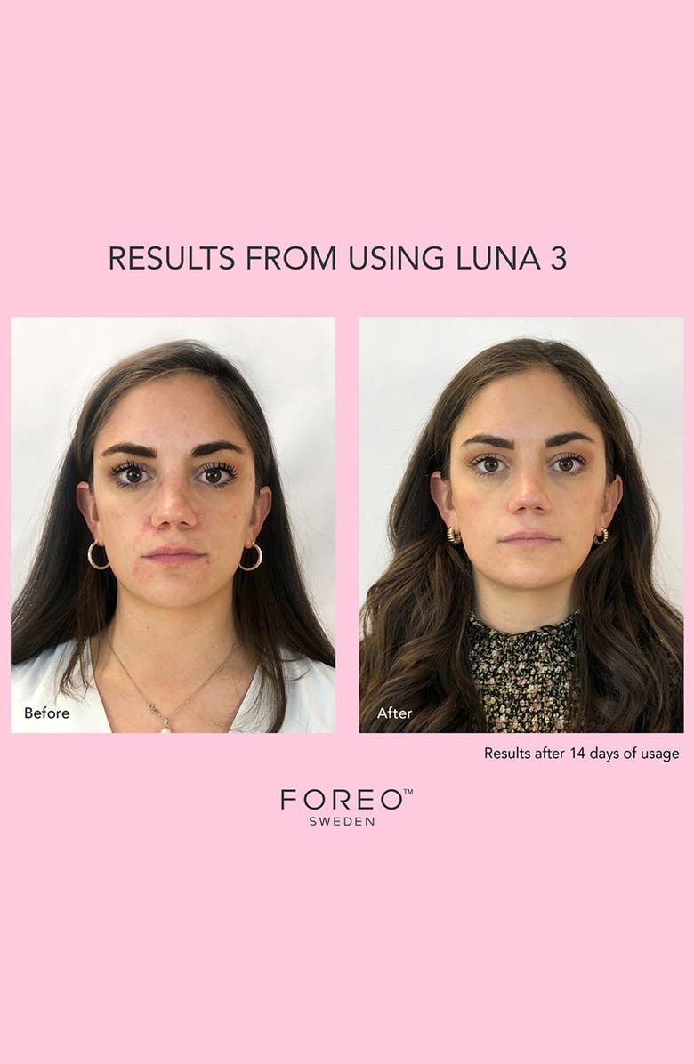 FOREO LUNA<sup>™</sup> 3 Normal Skin Facial Cleansing & Firming Massage Device, Alternate, color, 
