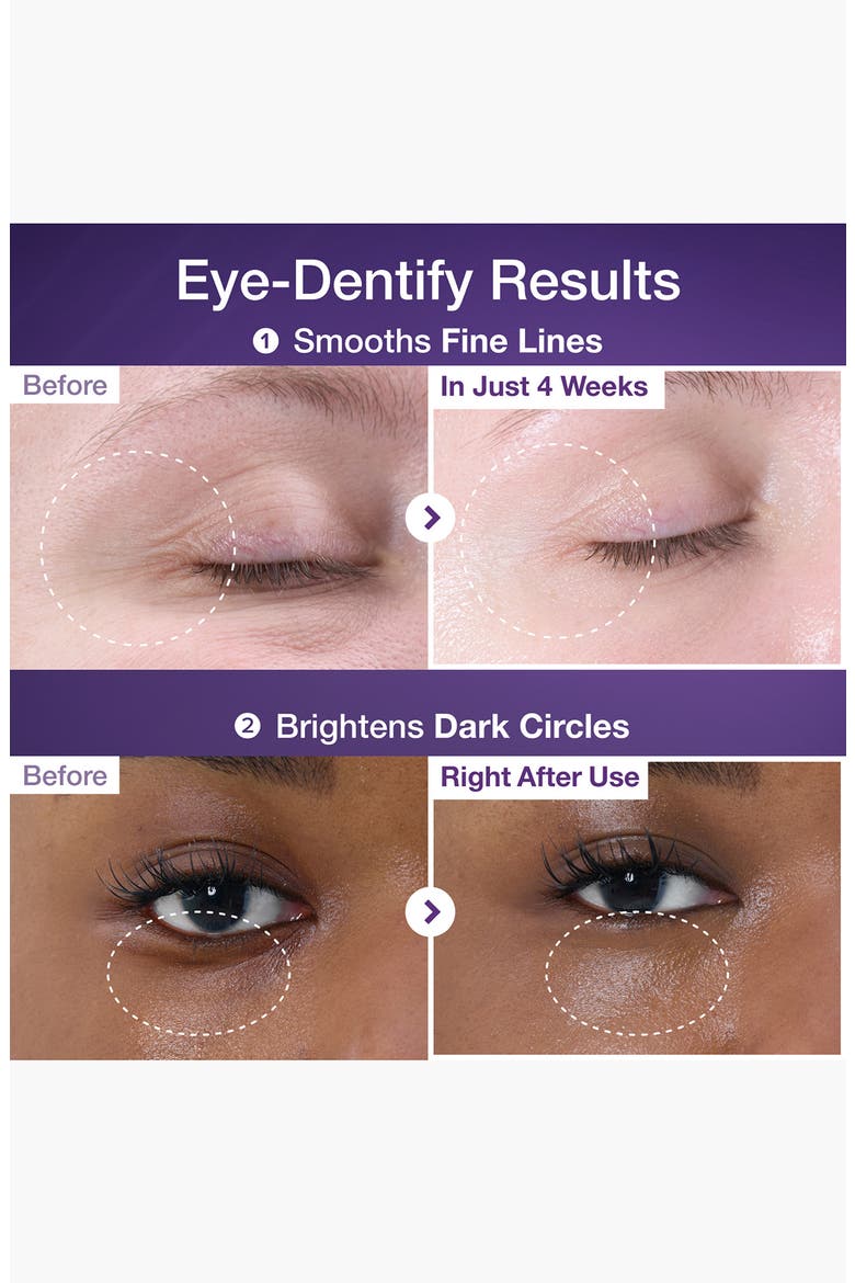 No.9 NAD+ Retinol Volumetox Eye Cream, Alternate, color, NO COLOR