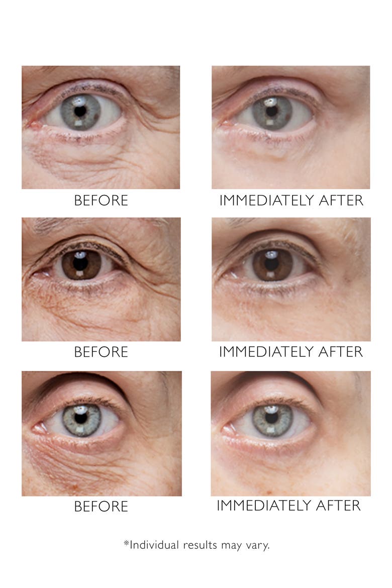 Instant FIRMx Eye Treatment, Alternate, color, NO COLOR
