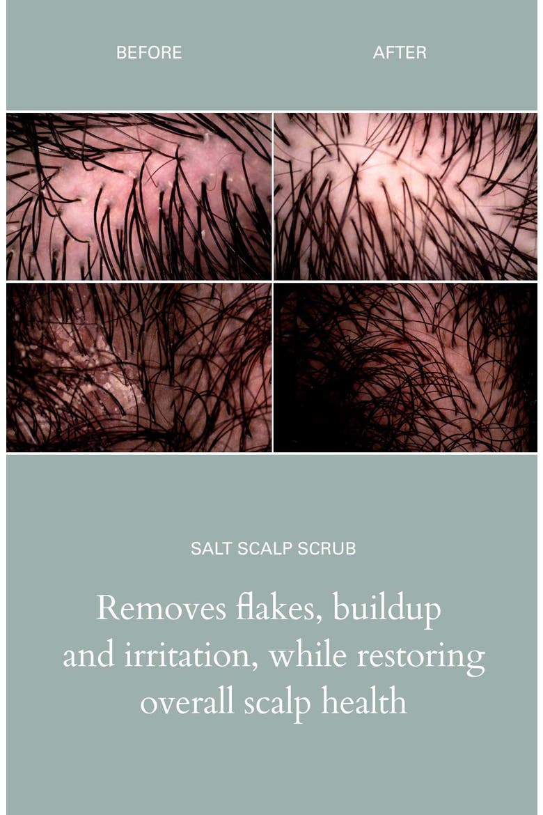 Salt Scalp Scrub, Alternate, color, NO COLOR
