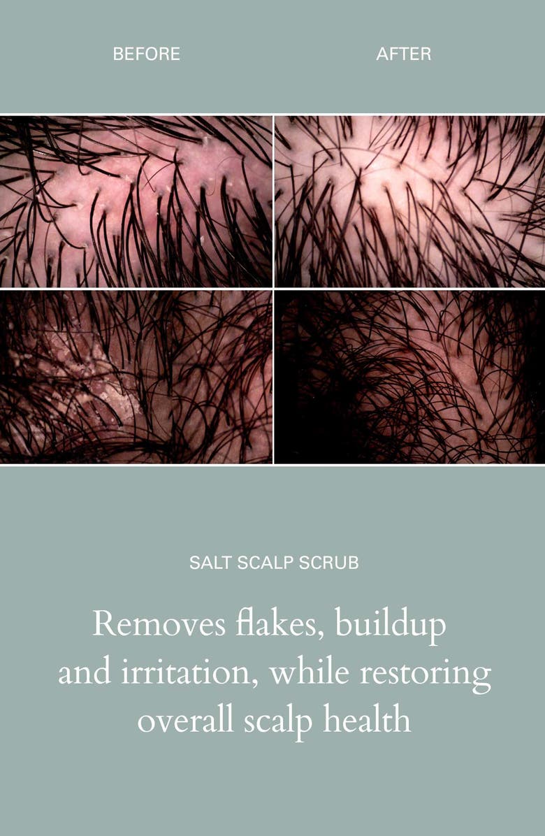 ROZ Salt Scalp Scrub, Alternate, color, 