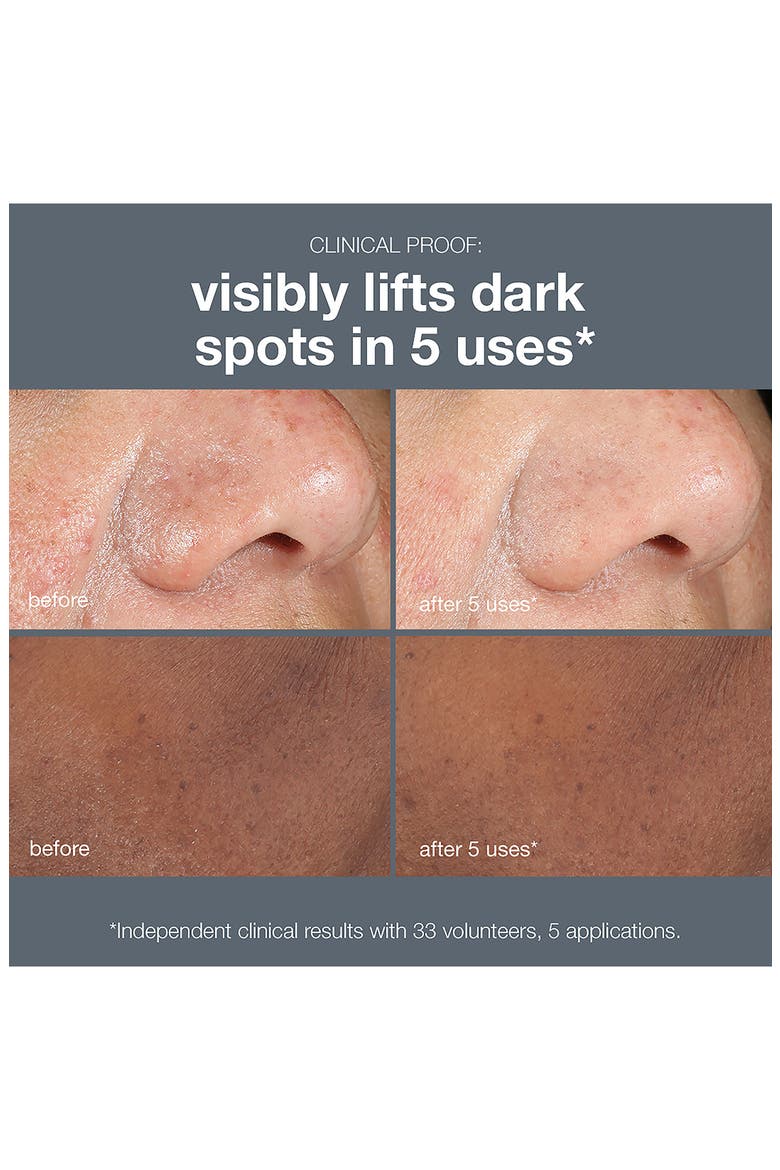 PowerBright Dark Spot Peel, Alternate, color, NONE