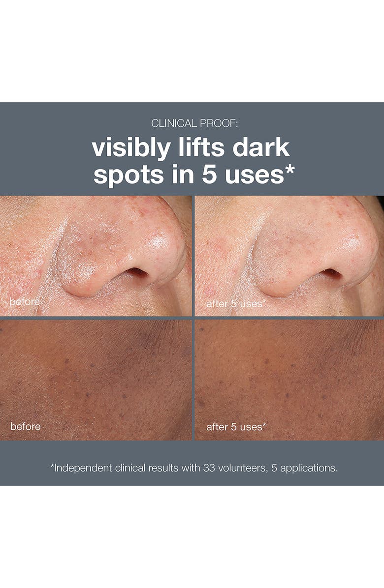 dermalogica<sup>®</sup> PowerBright Dark Spot Peel, Alternate, color,