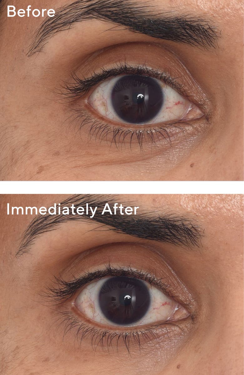 Murad<sup>®</sup> Dr. Zion Resurgence<sup>™</sup> Retinol Youth Renewal Eye Masks, Alternate, color,