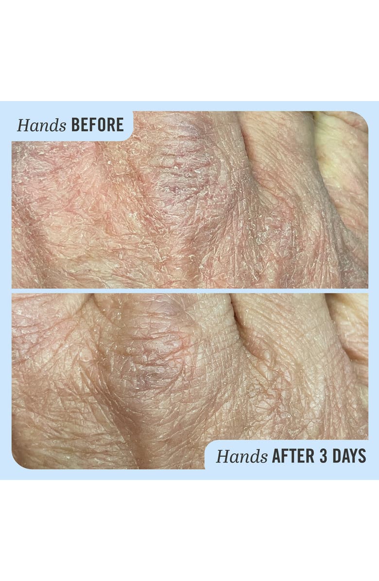 First Aid Beauty Ultra Repair Cream Intense Hydration Face & Body Moisturizer, Alternate, color, 