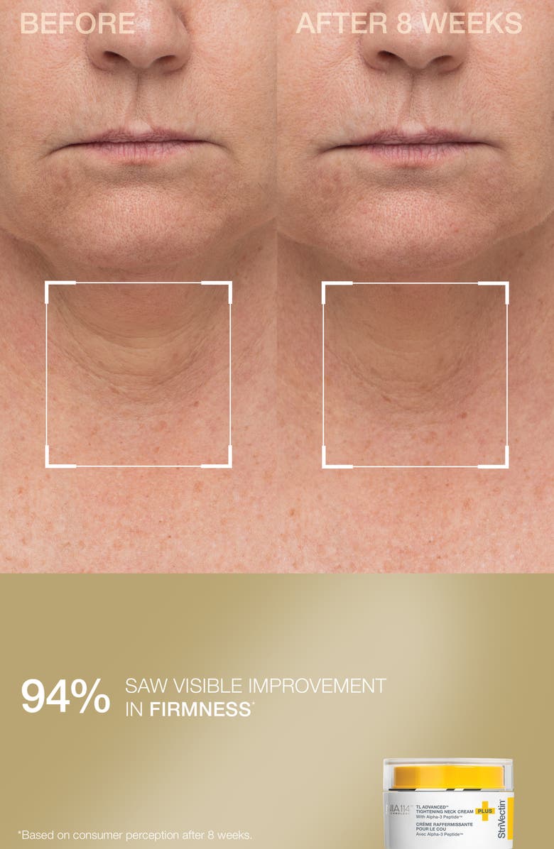 StriVectin<sup>®</sup> Counter & Tighten Set $158 Value, Alternate, color, 