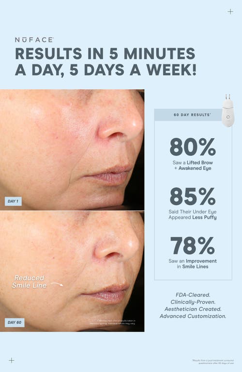 Nuface Trinity Complete Set With Augustinus Bader Skincare In No Color