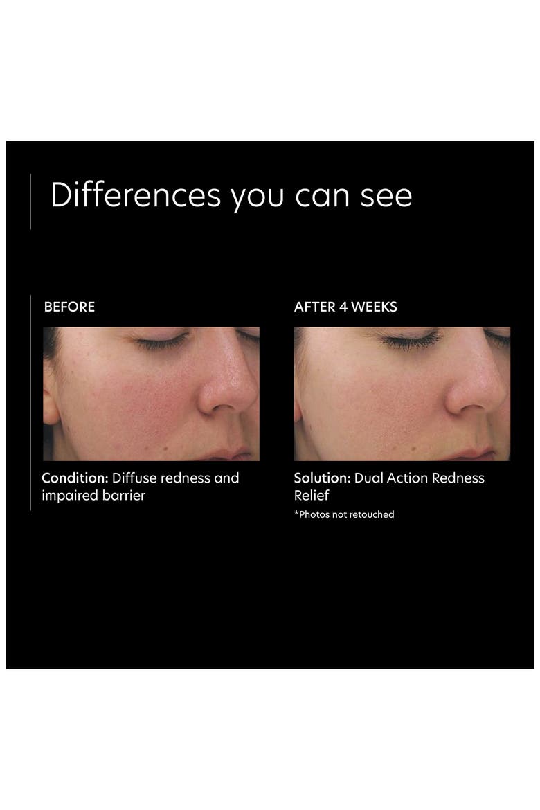 Dual Action Redness Relief Corrective Cream, Alternate, color, NO COLOR