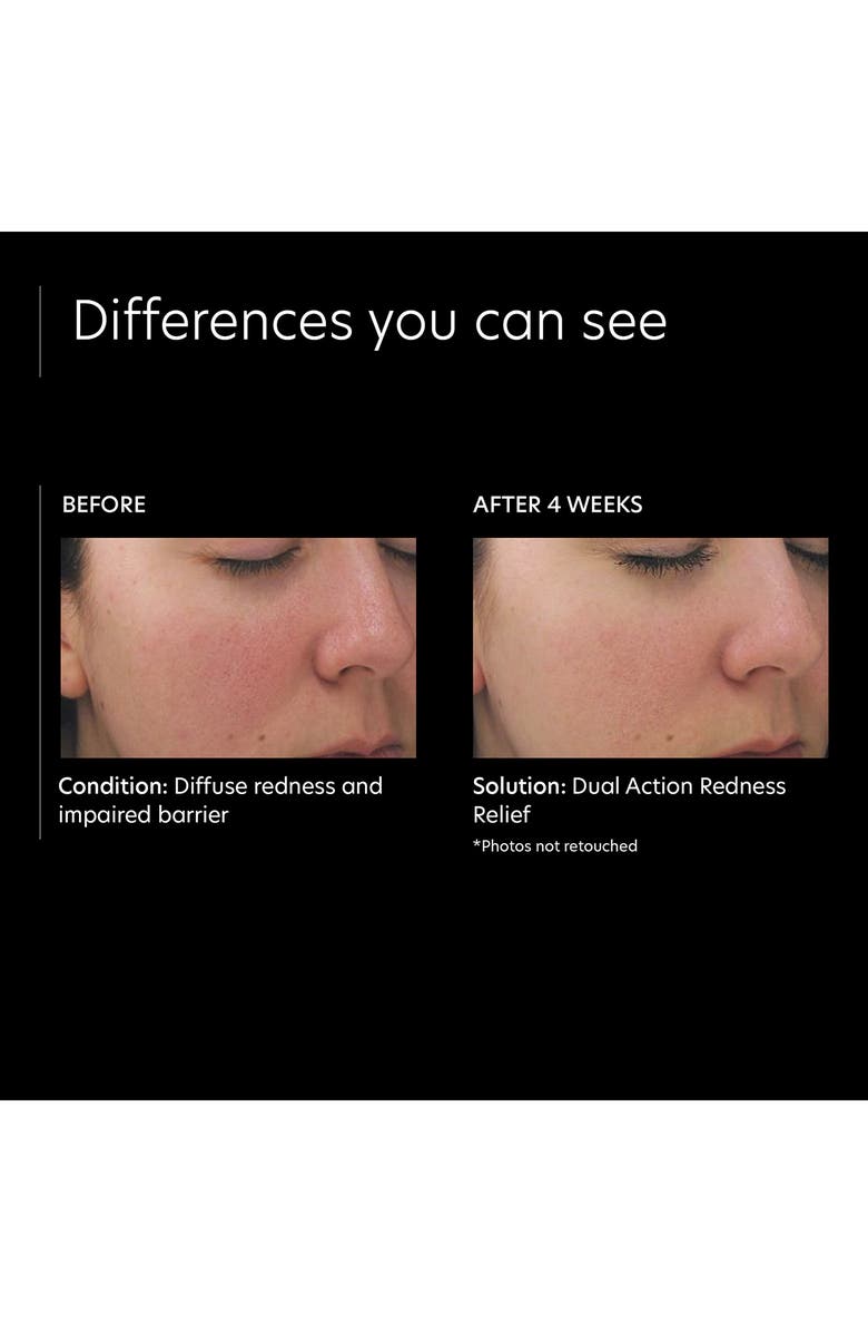 PCA Skin Dual Action Redness Relief Corrective Cream, Alternate, color,