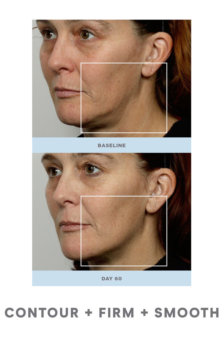 NuFACE<sup>®</sup> NuFace Refreshed NuFACE Trinity<sup>®</sup> Facial Toning Device, Alternate, color, 