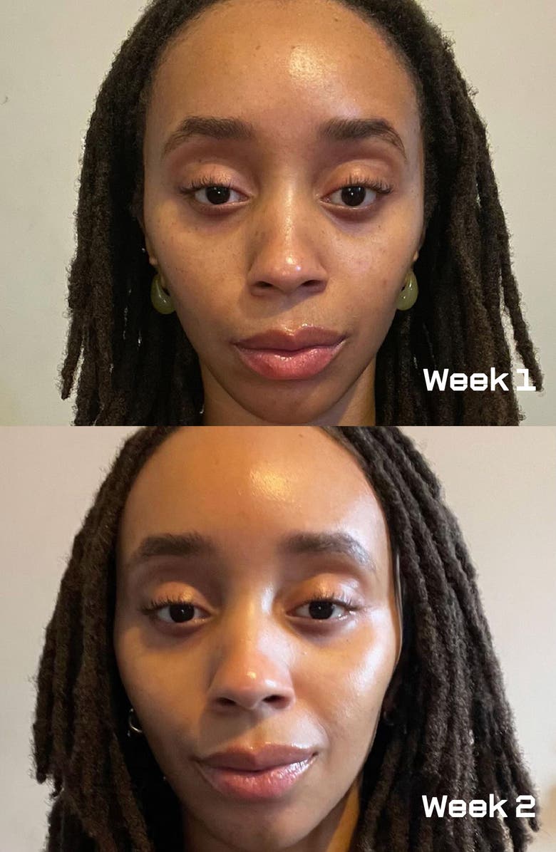 epi.logic Master Plan Collagen Renew Growth Factor Serum, Alternate, color, 